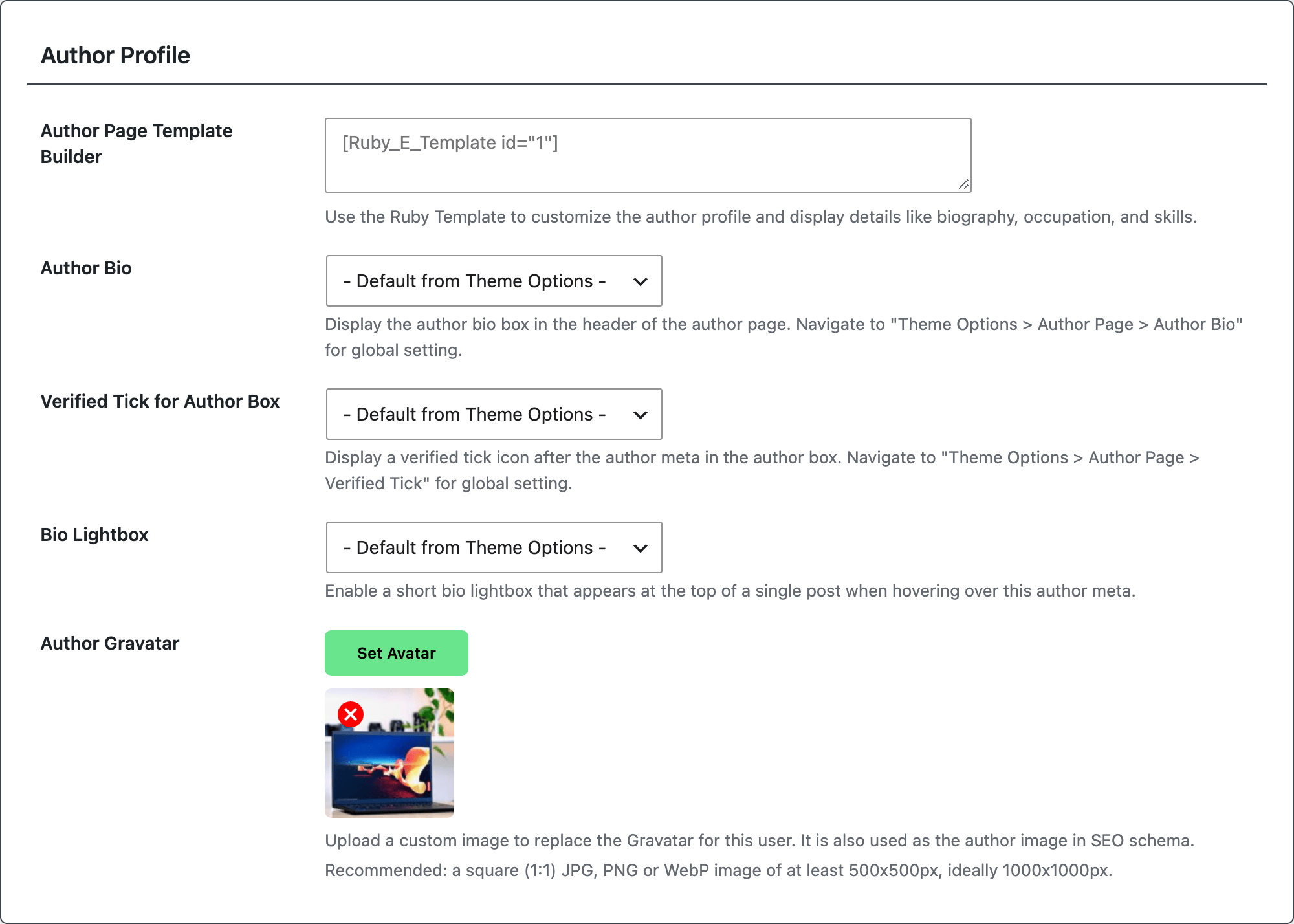 The Author Profile table Foxiz Core adds to the user profile screen, holding Author Page Template Builder, Author Bio, Verified Tick for Author Box, Bio Lightbox and Author Gravatar